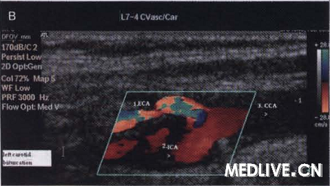 B��������ͼ����ʾ���⶯������Ѫ��(1)�������⶯����Ѫ�����ڶ���֮˳��Ѫ��(2)�����ܶ�������(3)