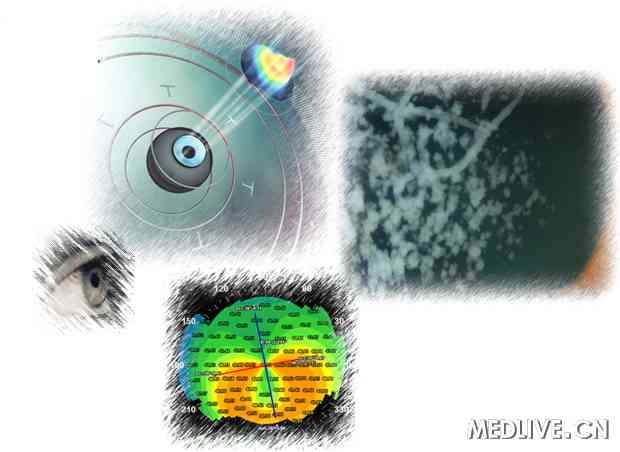 ��Ĥ��ֲ������ҽ��ͨ��ͼ��