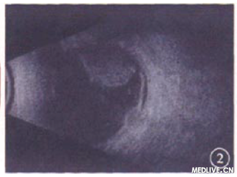 ͼ2��������B�ͳ����񡣲������ڻ�����ǿ���ţ�����Ĥǰǿ�������������Ĥǰ��Բ��¡��