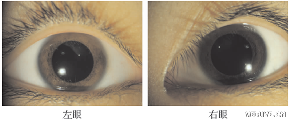 ͼ1���ۺ�Ĥ�ʵ���ɫ��ɫ�����Ե�������