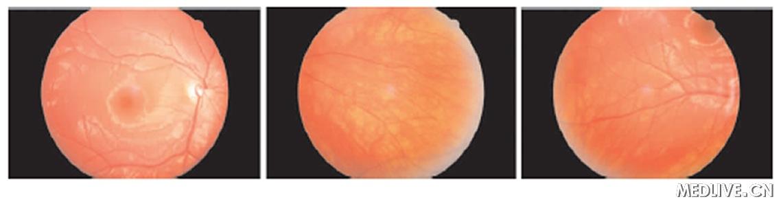 ͼ2���۵׳ʳȺ�ɫ������ͷ��ɫ����Χ��ɫ���ڷ��壬�ư�����    �����ⲻ�壬���ܲ�����Ĥ����ĤѪ������͸����