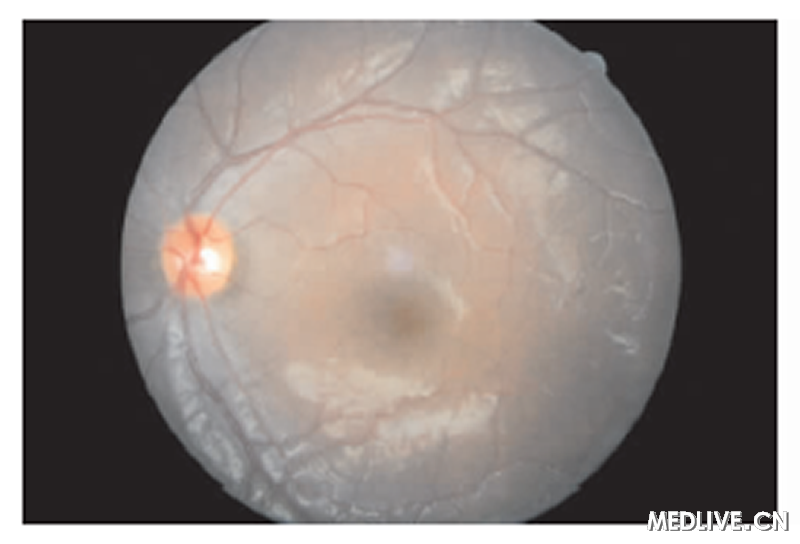 ͼ3���۵�δ���쳣