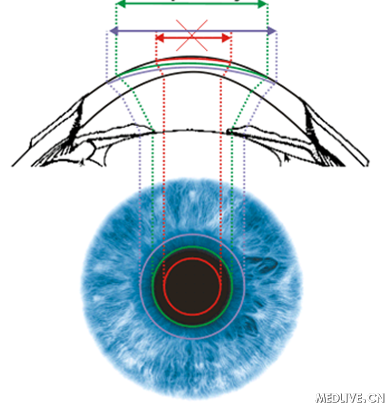 ͫ�׵Ĳ�����ҽ��ͨ��ͼ��