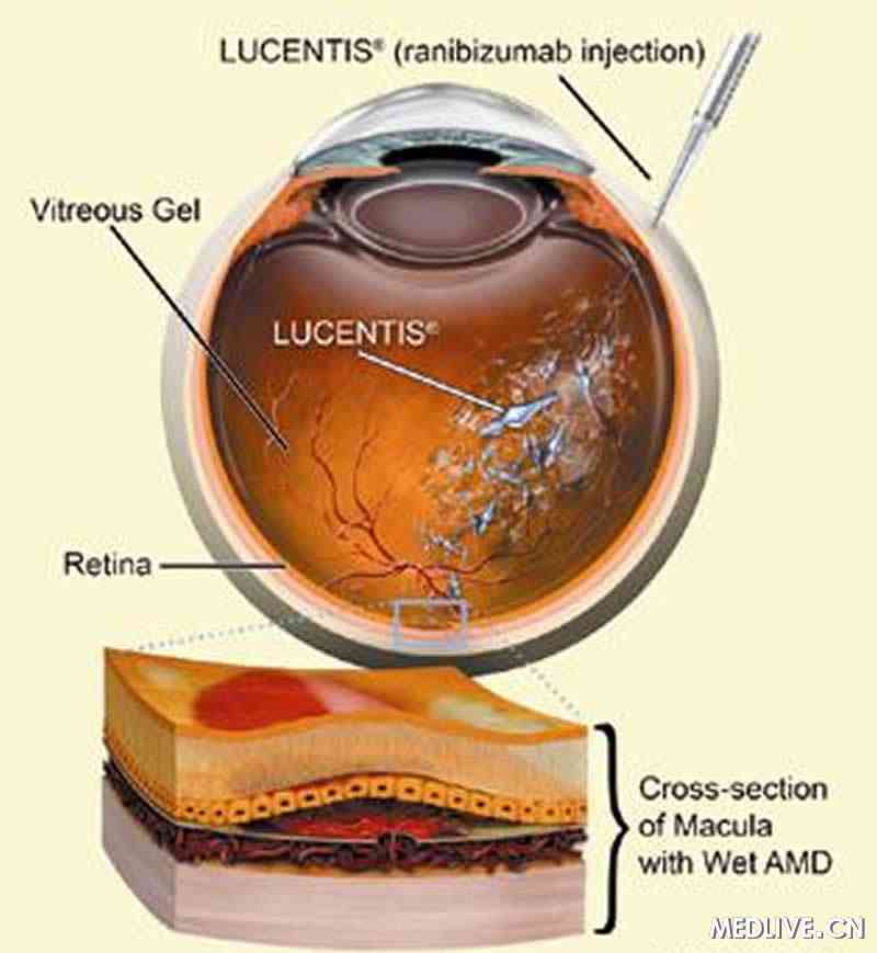 ���ᵥ������ע��