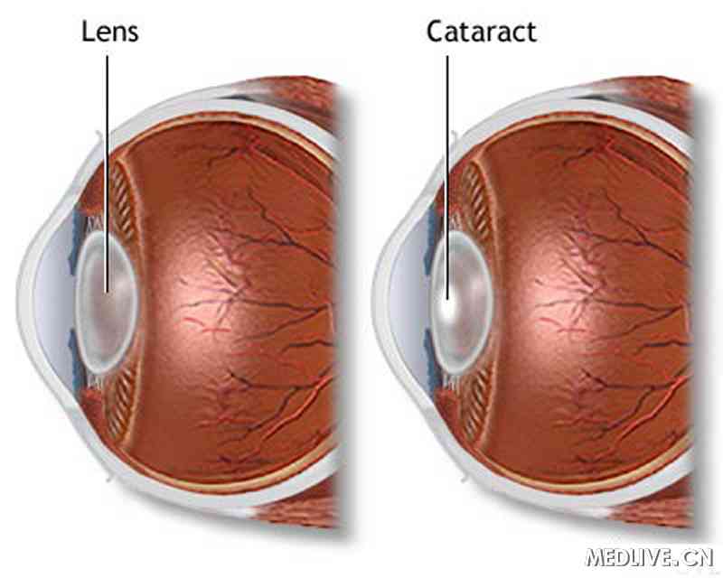 ������״��������ϻ��ߵľ�״��