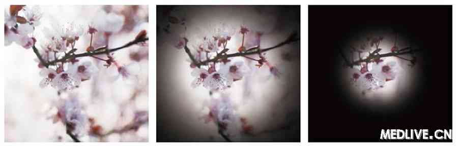 ͼ4 ����۵�����Ұȱ��Ĳ����չ