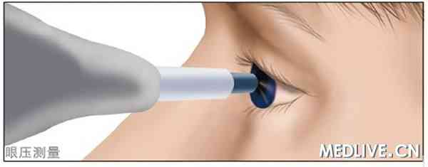 ͼ1 ��ѹ����