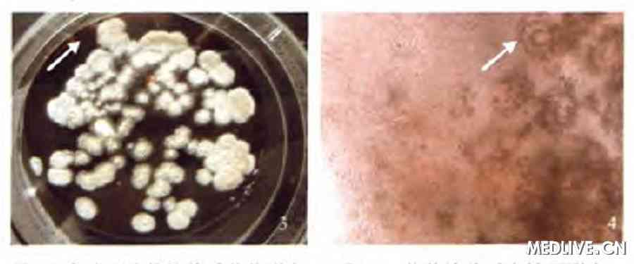 ͼ3 ��Ĥ��ȡ�����������״̬ ͼ4����ͿƬ��⾵����̬