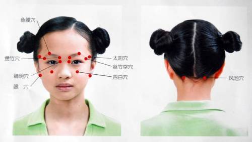 ���۱�����ͼ��-Ѩλ