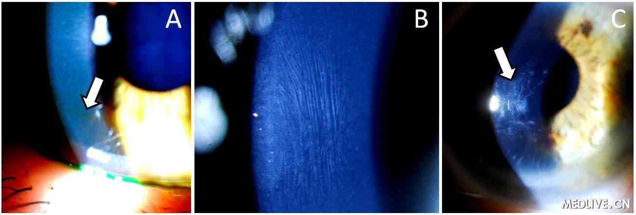 Բ׶��Ĥ��������