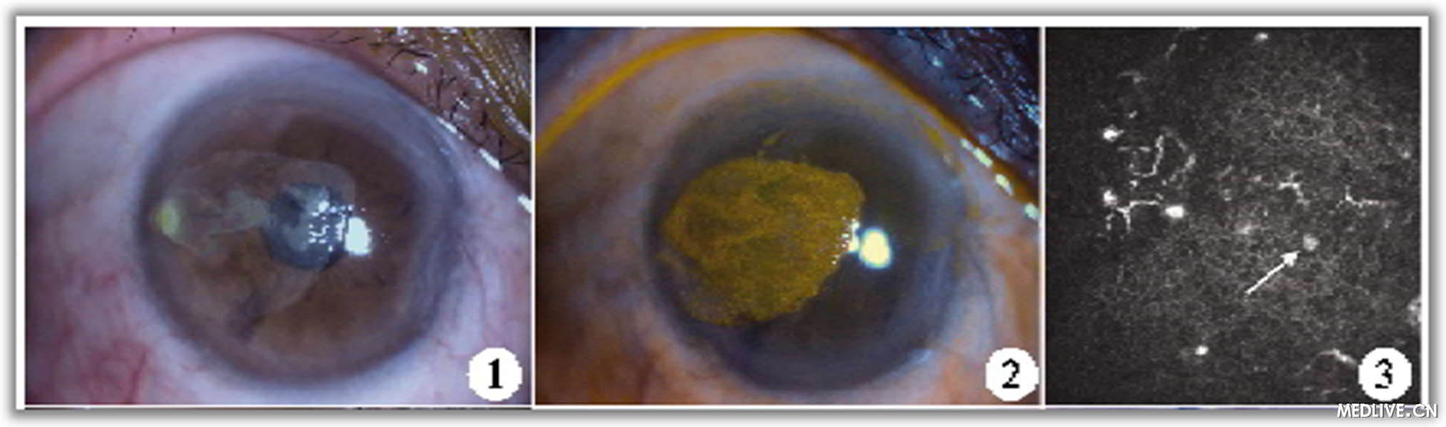 ��Ĥ��Ƥ����