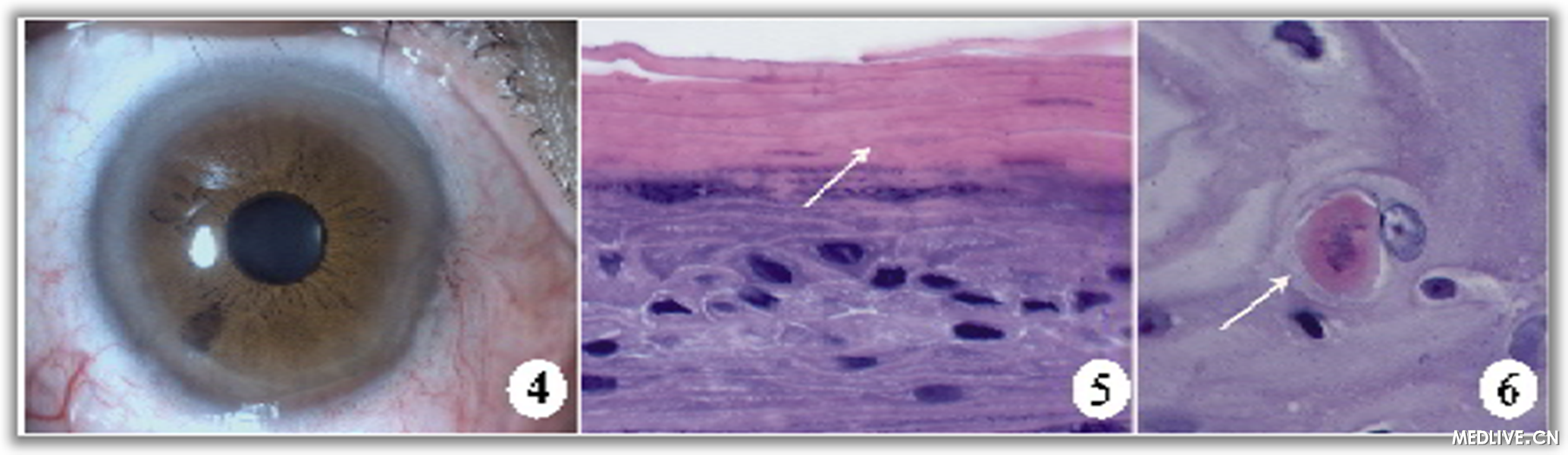 ��Ĥ��Ƥ����