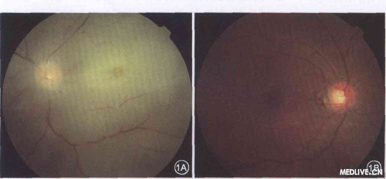 ���۶����������߲�ɫ�۵�ͼ��