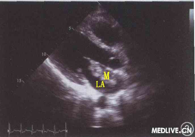 ͼ3���۶����������������ɫ����ͼ����ʾ���ķ����Һ��