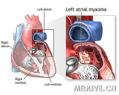 ҽ��ͨ��ͼ����ճҺ��