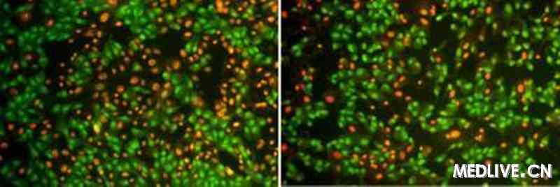 IOVS����ҩ�Ե���ɷֶ�����Ĥ���б�������