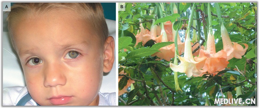 NEJM�������ڻ�԰���ͫ��ɢ��