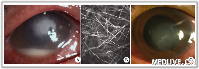 ���干�۽���΢���������Խ�Ĥ��һ��