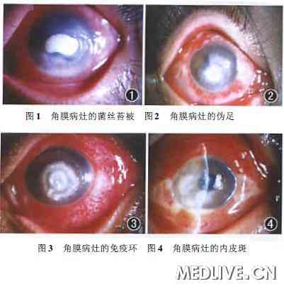 ���干�۽���΢���������Խ�Ĥ��һ��