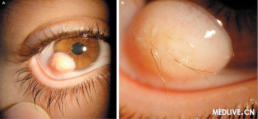 NEJM������ë��������