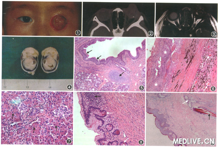 ���ڻ�̥��һ��