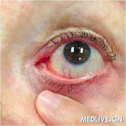 ��С����