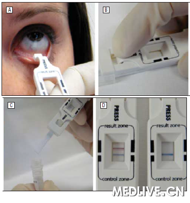 �¼�����������ٲ����Խǽ�Ĥ��