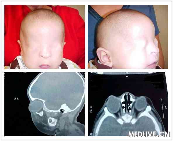 ���ۻ���