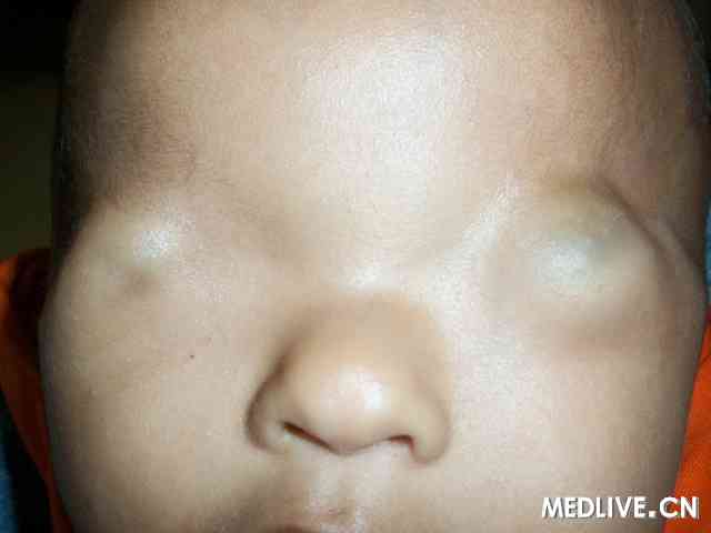 ���ۻ���