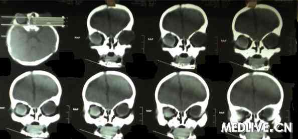 ���ۻ���