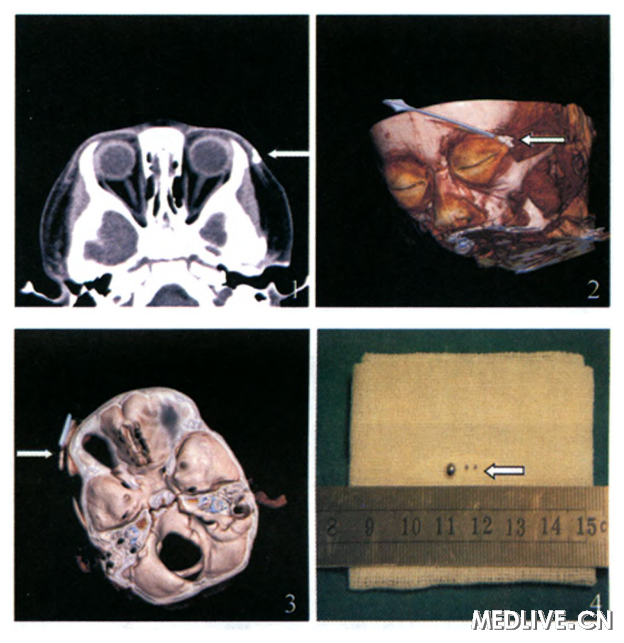 ���¼��۶Ϻ���������