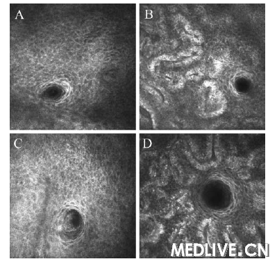 LSCM���������������״̬��ֵ�ɹ�