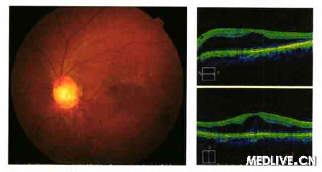 ����������С������ɹ�ϲ�ɨ��һ��