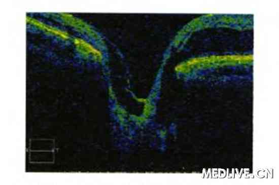 ����������С������ɹ�ϲ�ɨ��һ��