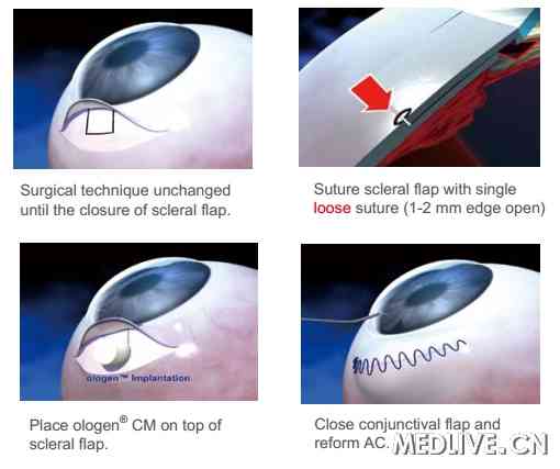 ֲ��ʽ֧�� vs ˿��ù��C��С���г�����ѡ��