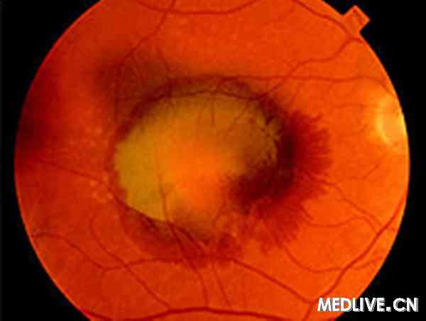 ��˾ƥ����AMD�����Ҷ���Ҫ��������