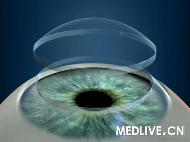 DSEK��PKP��3��Ƚ�