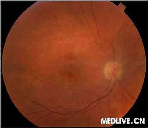 һ����÷����ʷ������ɥʧ����