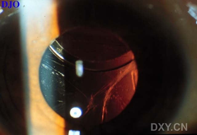 ��Щ�꣬�������������۲�������ͼ�׵�������