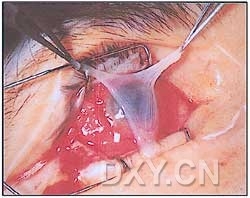 ��Щ�꣬�������������۲�������ͼ�׵�������