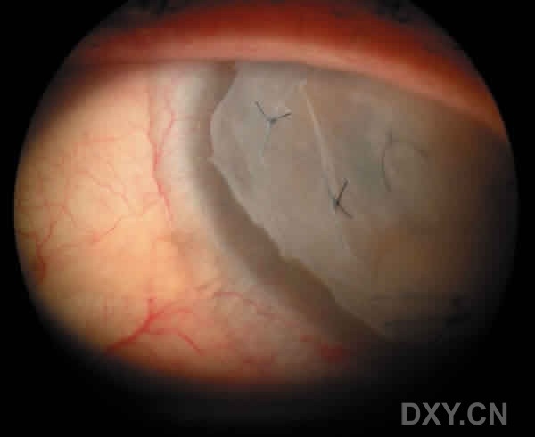 ��Щ�꣬�������������۲�������ͼ�׵�������