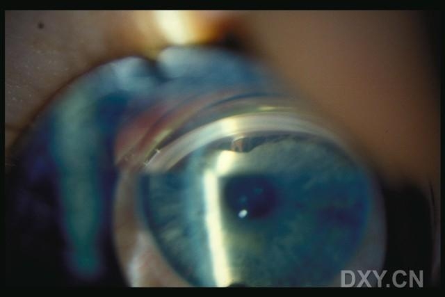 ��Щ�꣬�������������۲�������ͼ�׵�������