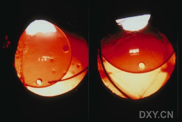 ��Щ�꣬�������������۲�������ͼ�׵�������