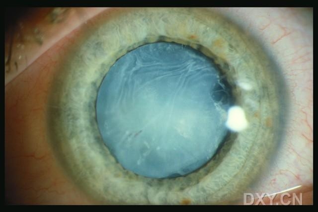 ��Щ�꣬�������������۲�������ͼ�׵�������