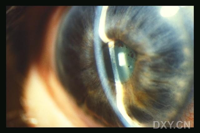 ��Щ�꣬�������������۲�������ͼ�׵�������