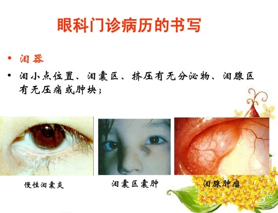 �ۿƲ�����������д