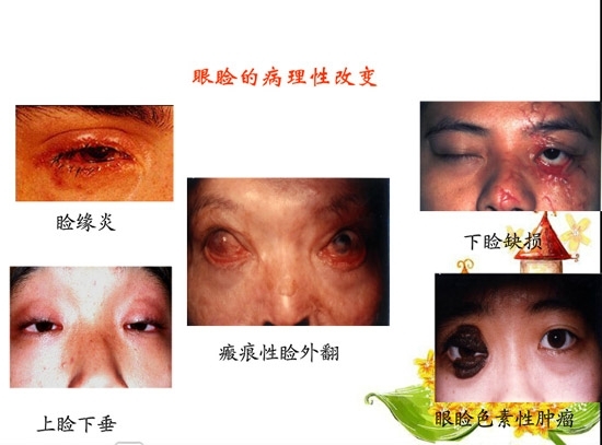 �ۿƲ�����������д