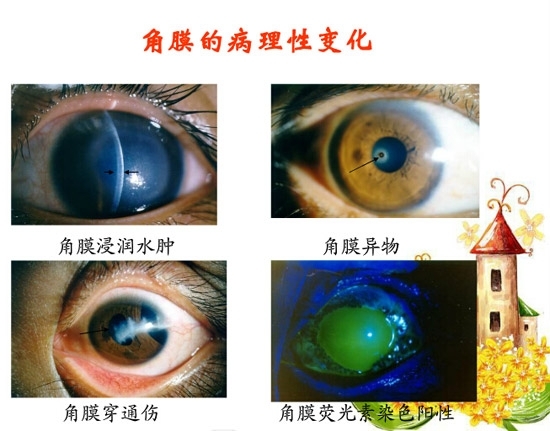 �ۿƲ�����������д