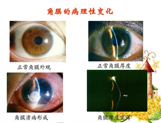 �ۿƲ�����������д