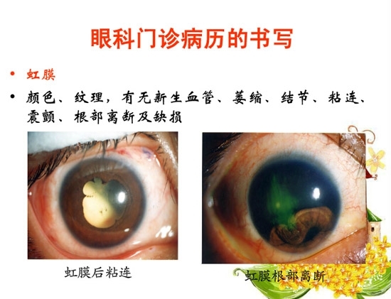 �ۿƲ�����������д